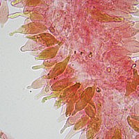 Чешуйчатка чешуйчатовидная (Pholiota squarrosoides). Плевроцистиды и Плеврохризоцистиды