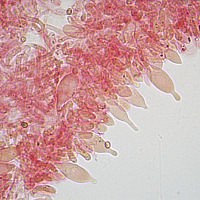 Чешуйчатка чешуйчатовидная (Pholiota squarrosoides). Плевроцистиды и Плеврохризоцистиды
