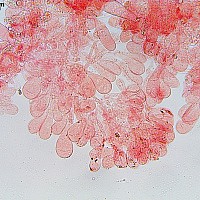 Плютей ивовый (Pluteus salicinus). Хейлоцистиды.