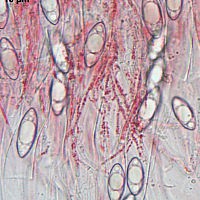 Микростома вытянутая (Microstoma protractum)