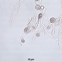 Себацина наземная (Sebacina epigaea). Базидии