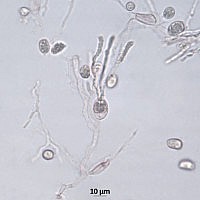 Себацина наземная (Sebacina epigaea). Базидии